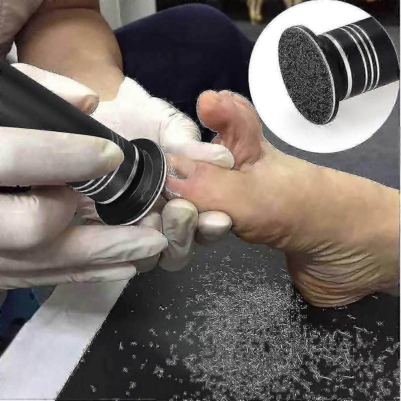 Upgraded Electric Callus Remover with Adjustable Speed and 60 Replacement Discs for Professional Pedicure (Men & Women)