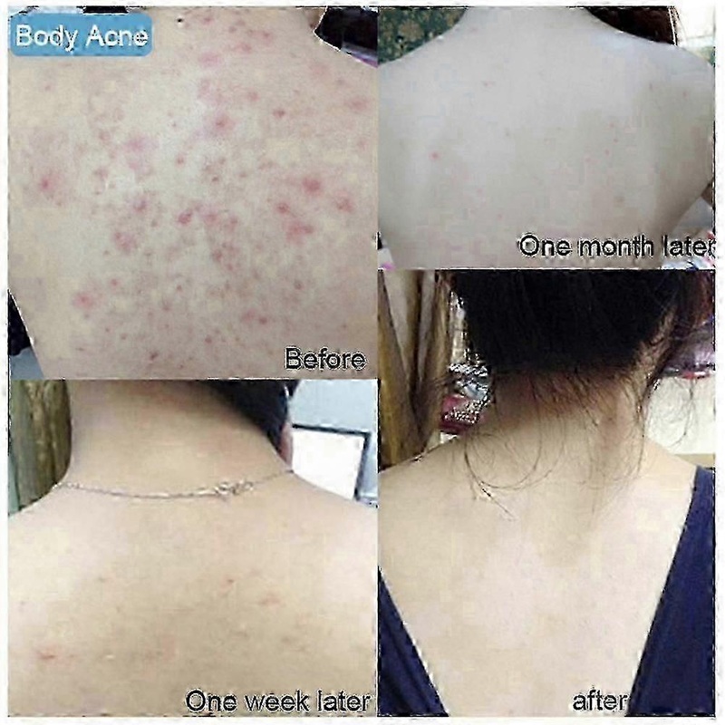2025 100g Sea Salt Whitening Soap Cleaner Removal Pimple Pores Acne Treatment Moisturizing Face Wash Soap Skin Care Db