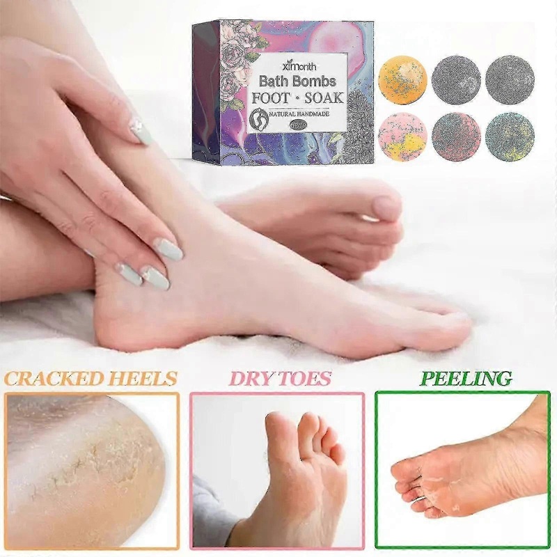 6pcs Foot Bath Bombs, Natural Foot Bath Bombs Gift Set With Essential Oils, Foot Bath Bombs For Women Men Athletes R