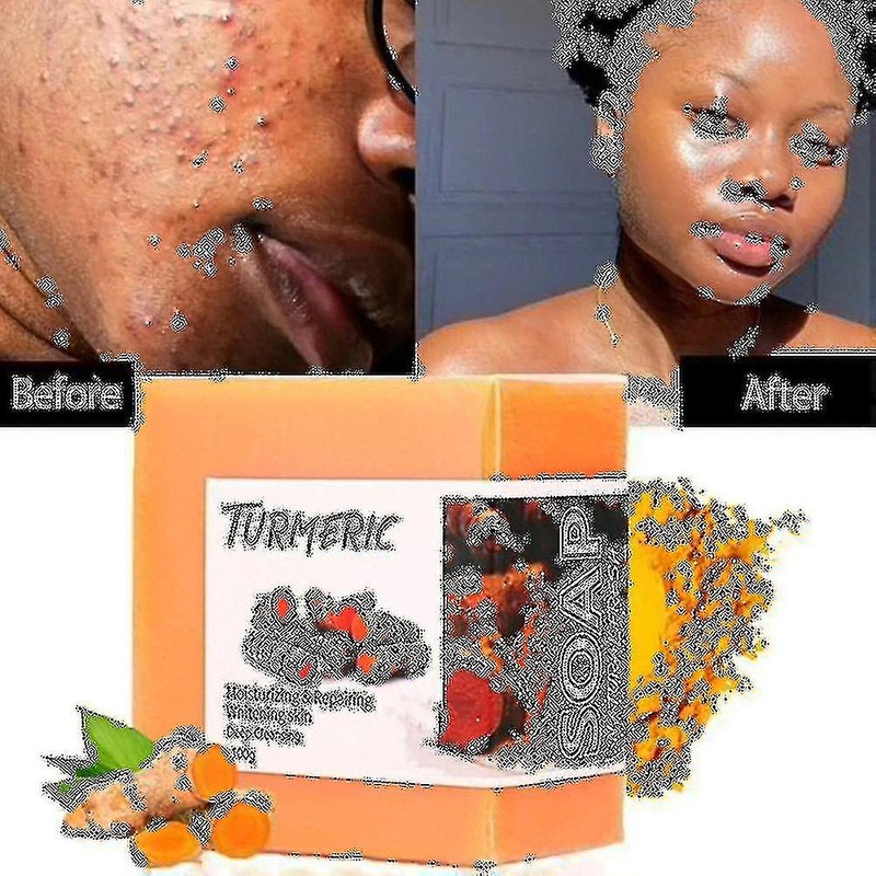100g Turmeric Soap Slimming Natural Cleansing Soap For All Skin Types