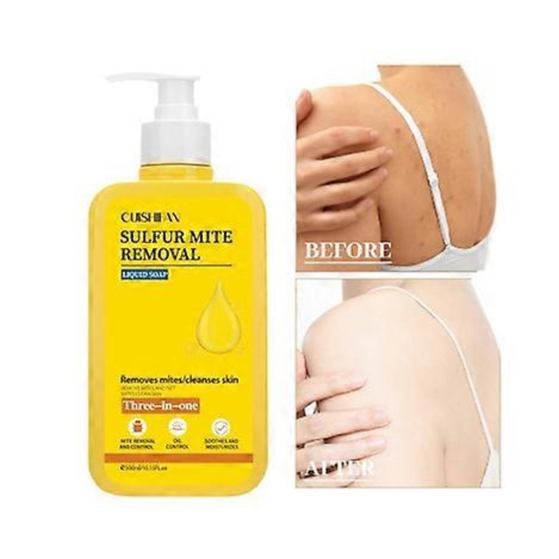 Sulfur Refreshing Shower Gel Against Body Odour & Acne, Antibacterial Sulphur Formula with Deep Cleansing for Sensitive Skin, PH Neutral & Vegan, 300M